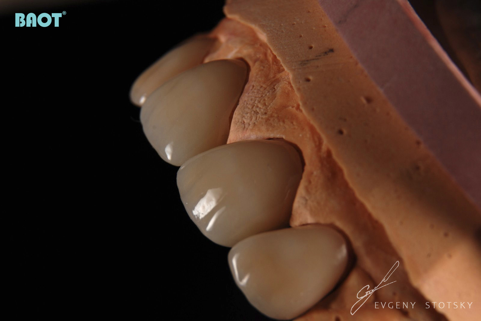 Ceramiczny materiał dentystyczny w proszku do odbudowy