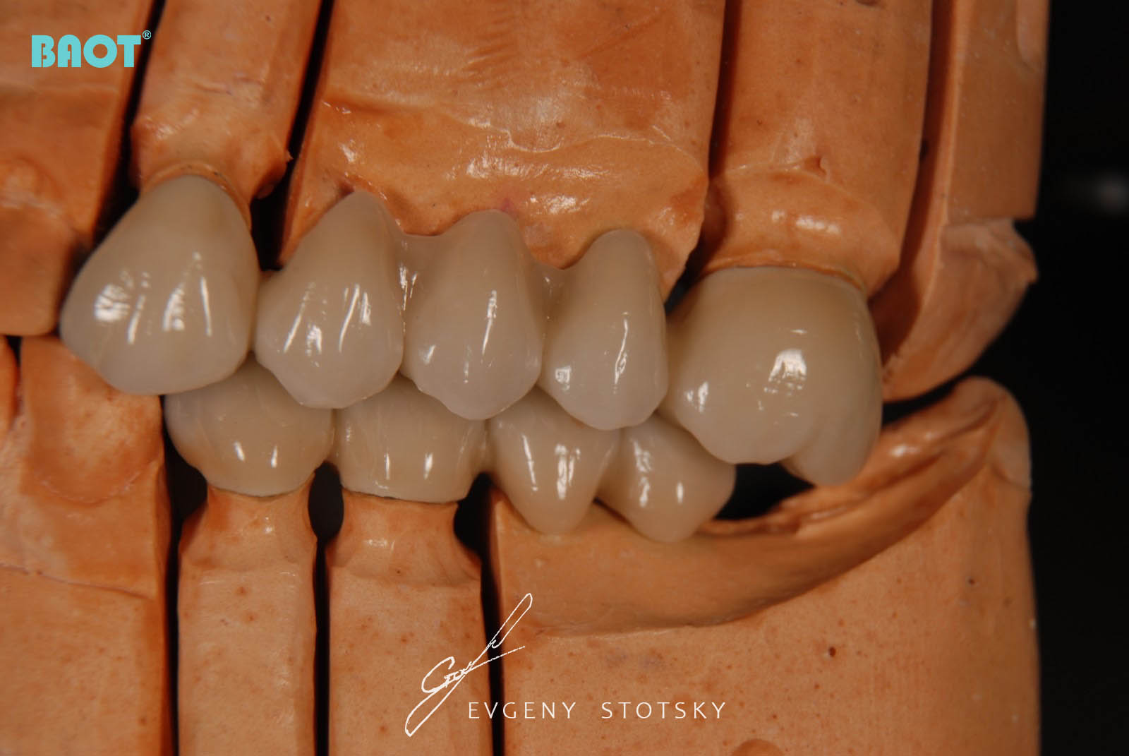 Zastosowanie ceramiki do protez dentystycznych