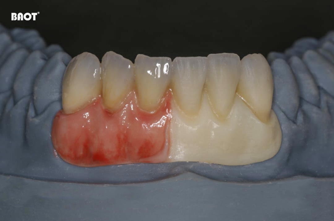 Technika stomatologiczna w postaci pasty barwiącej BAOT