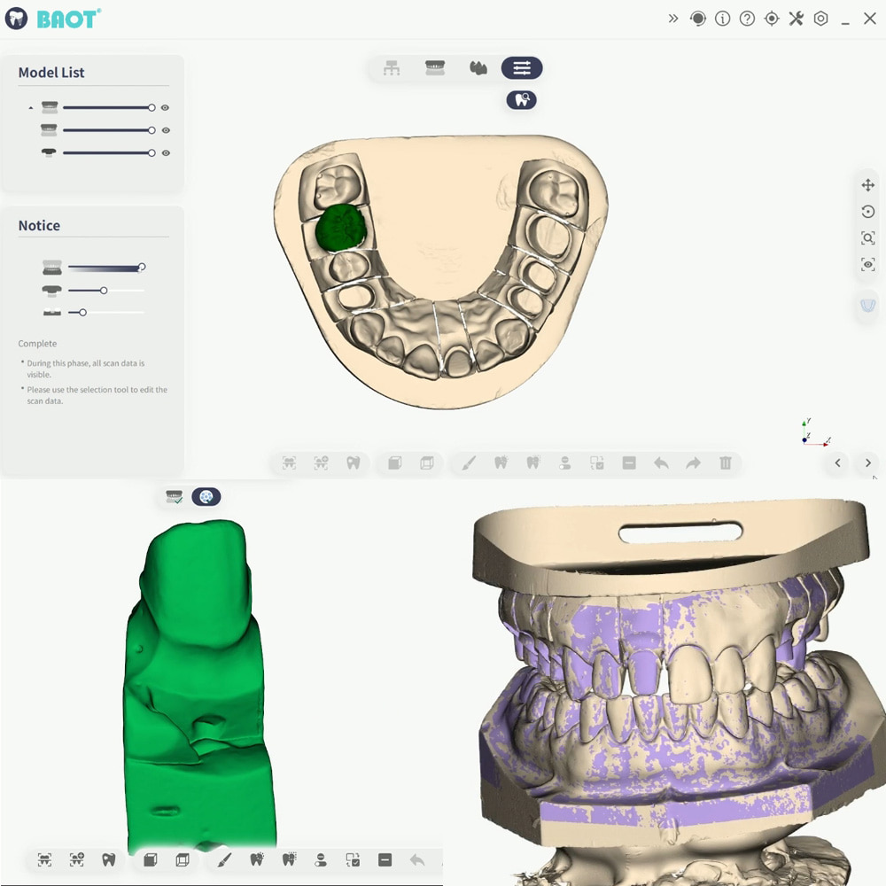 Skaner dentystyczny 3D Skanowanie dolnej szczęki