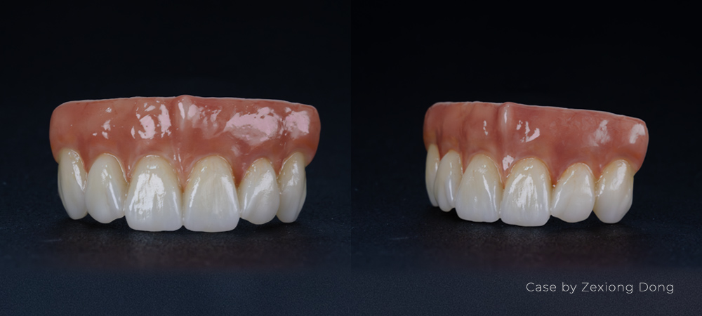 BAOT Pink Gingiva Stain Dental Lab Case BAOT Pink Gingiva Stain Dental Lab Case