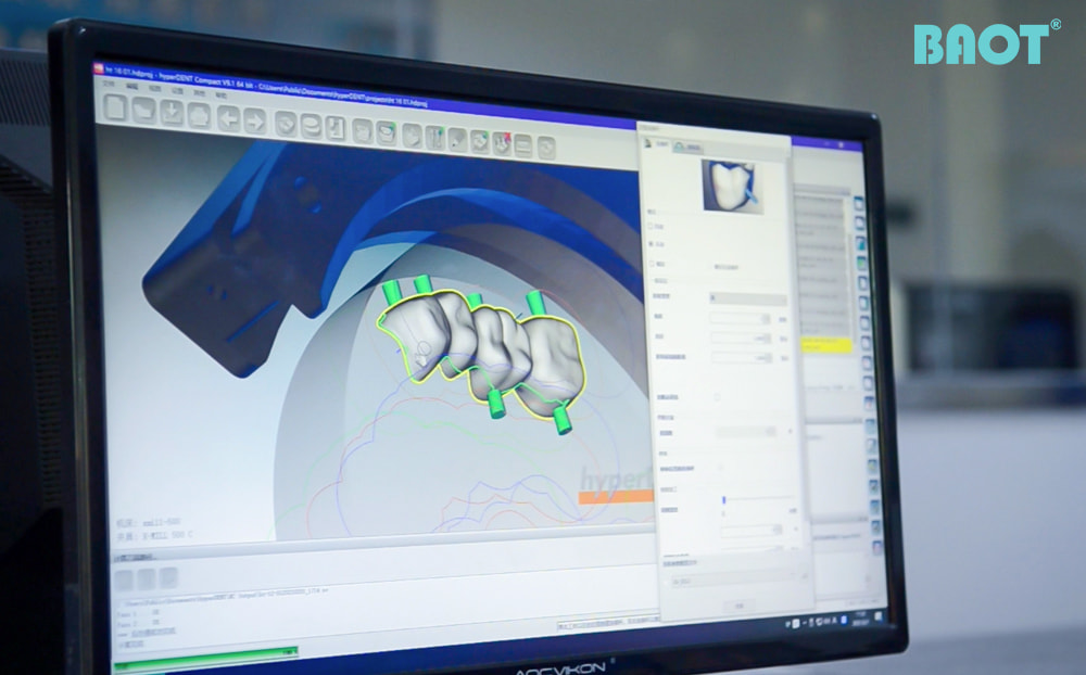 Rola bloków cyrkonowych w przyszłości stomatologii cyfrowej